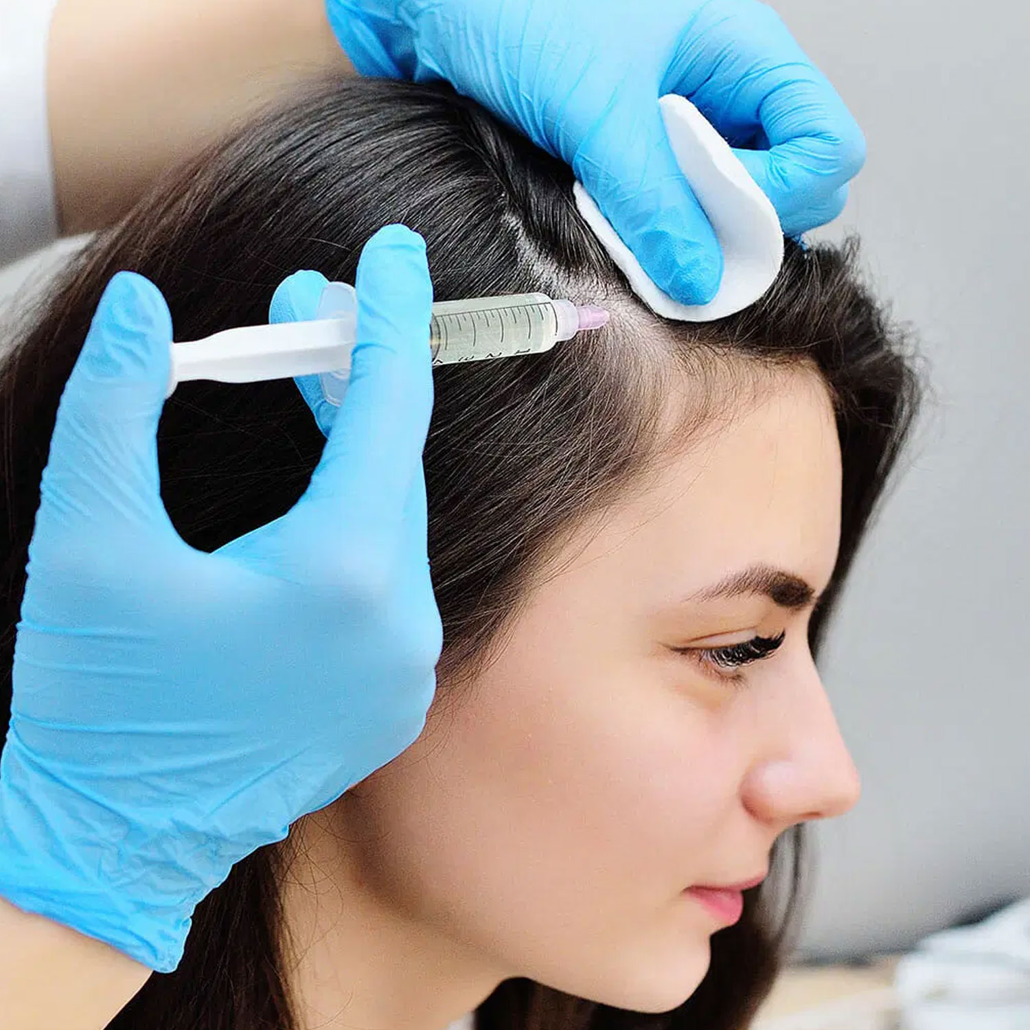 PRP-Treatment-karachi---Deduce-Aesthetic-and-Beauty-clinic