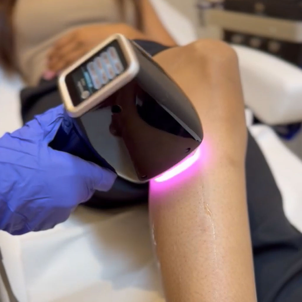 Laser-Hair-Removal-Treatment-karachi