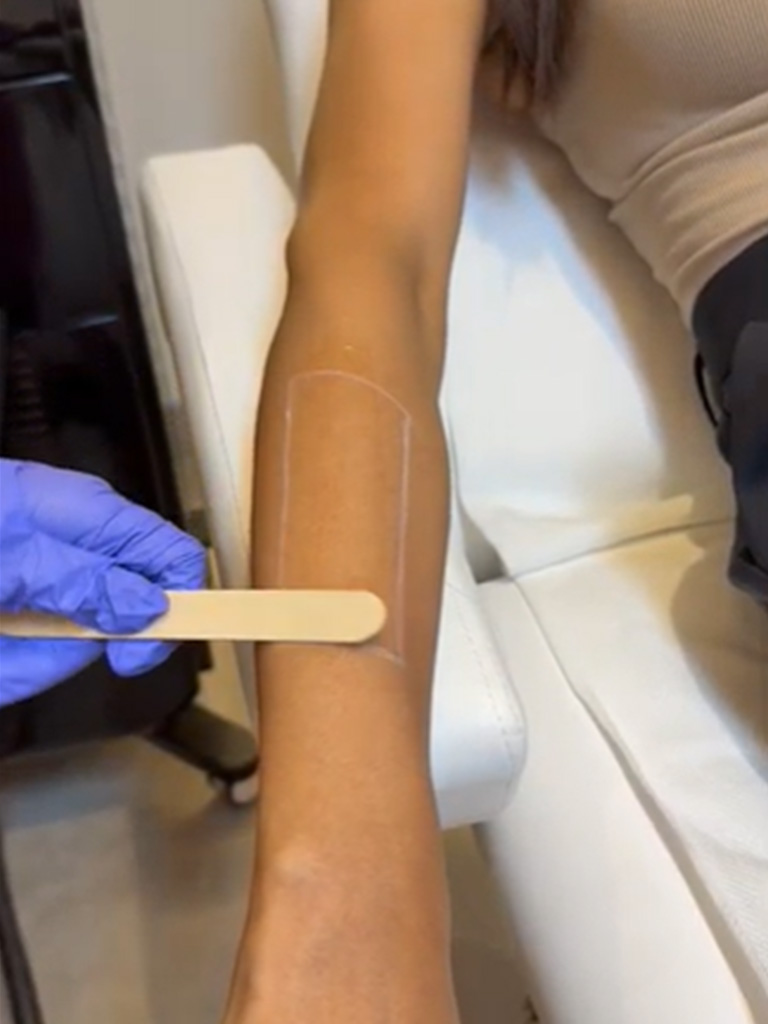 Laser-Treatment-Carousel (1)